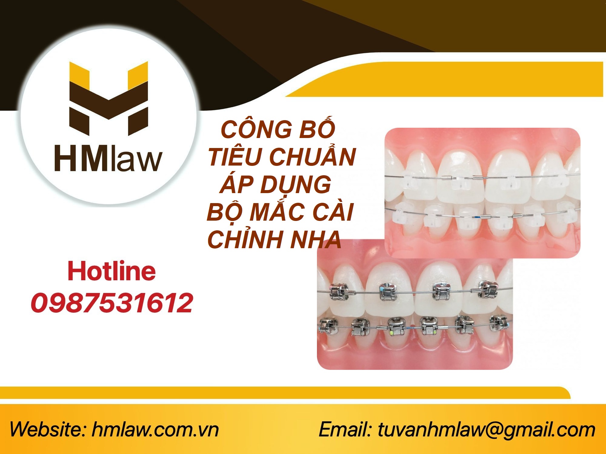 Công bố tiêu chuẩn áp dụng bộ mắc cài chỉnh nha