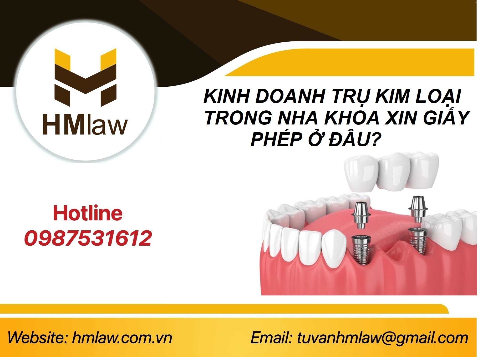 Công bố đủ điều kiện mua bán trụ kim loại trong nha khoa