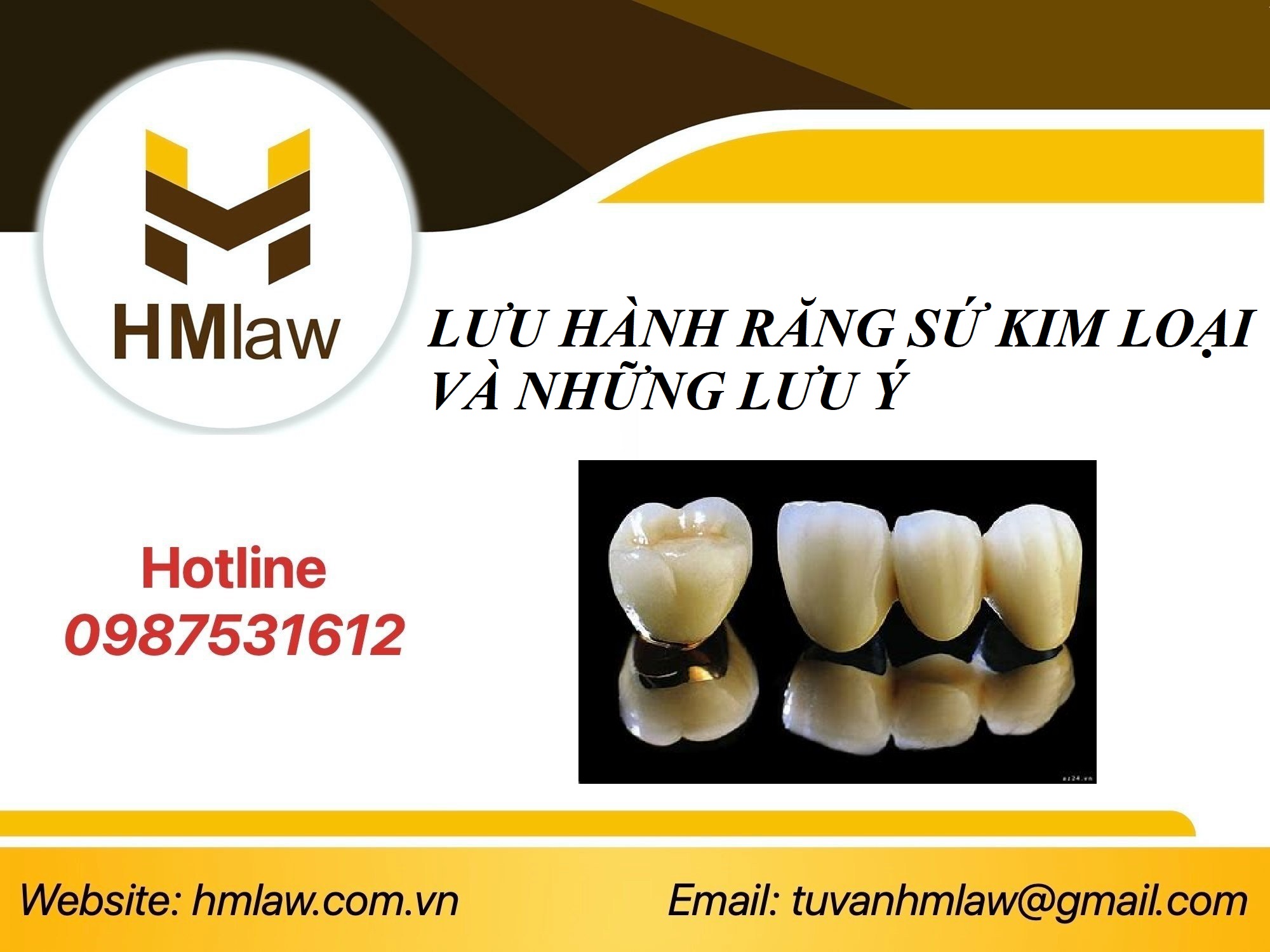 LƯU HÀNH RĂNG SỨ KIM LOẠI VÀ NHỮNG LƯU Ý 